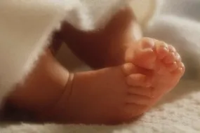 السمنة قبل الحمل- خطر التوحد العصبي على الأطفال
